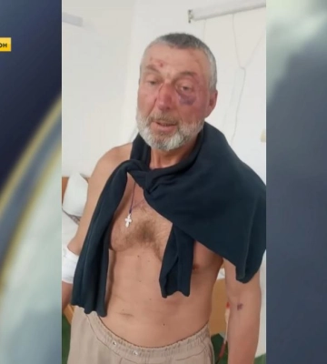 Що відомо про побиття ветерана від працівників ТЦК на Рівненщині (ВІДЕО)