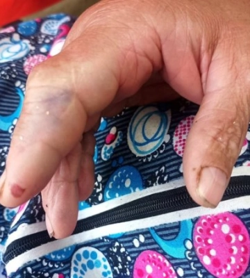 Смертельна пастка на власному подвір’ї: На Закарпатті гадюки почали полювати на людей прямо біля хат (ФОТО)