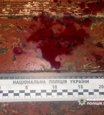 У Рівному чоловік ударив сусіда ножем у шию: нападнику повідомили про підозру