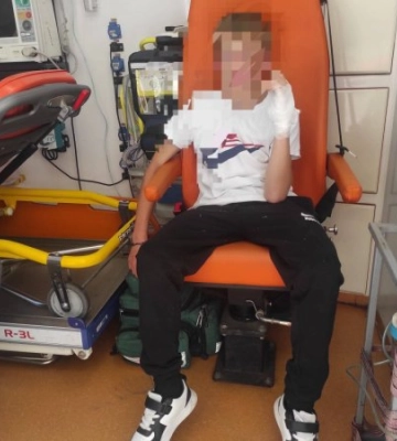 Секунди на порятунок: на Закарпатті медики виїхали на кривавий виклик до 14-річного підлітка