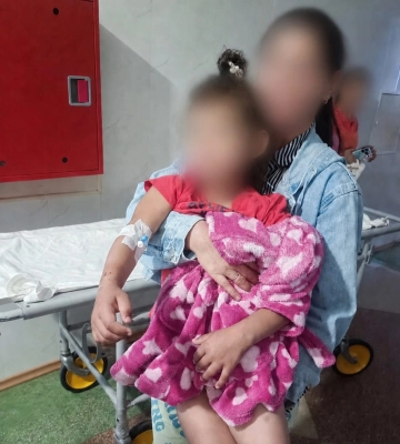 На Закарпатті двоє дітей проковтнули монети