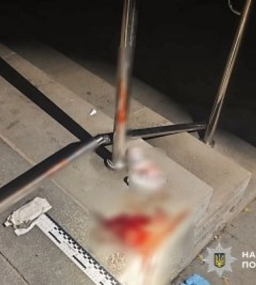 Завдав ножових поранень незнайомцю: у Миколаєві поліцейські оперативно розшукали зловмисника та повідомили про підозру