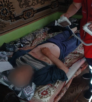 Зупинка серця, реанімація і шанс на життя: медики відновили кровообіг у пацієнта із Міжгірщини