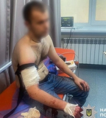 У Запоріжжі під час обшуку чоловік поранив ножем трьох поліцейських: вони застосували зброю