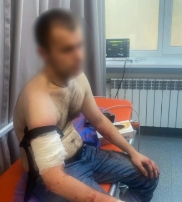 У Запоріжжі під час обшуку чоловік поранив ножем трьох поліцейських - його застрелили