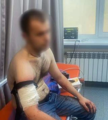 У Запоріжжі чоловік з ножем та сльозогінним газом напав на поліцейських: він загинув