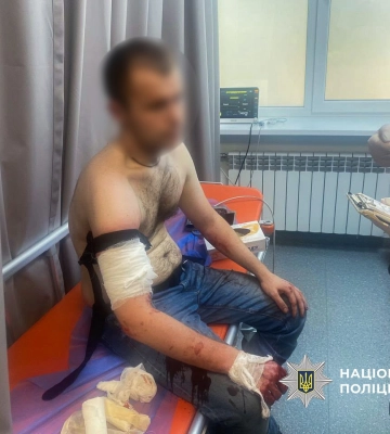 Поліцейські застрелили чоловіка, який напав на них з ножем у Запоріжжі