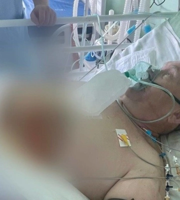 Під час ракетного обстрілу Полтави тяжко поранено Сергія Добридня: чоловік потребує дороговартісного лікування