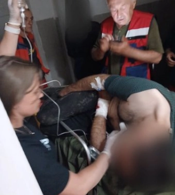 На Закарпатті жорстоко забили чоловіка до напівсмерті просто на вулиці, лікарі виривали жертву з лап смерті (ФОТО)