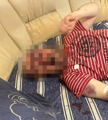 Побив сусіда через ревнощі та викрав у нього рушницю - у Львові підозрюють молодика