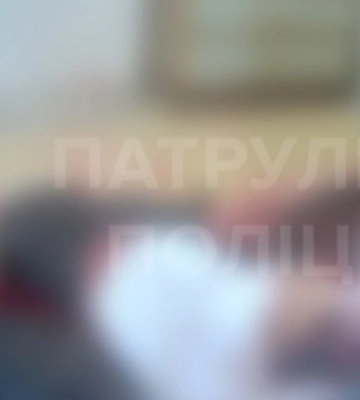У Чернівцях жінка перерізала собі вени: її знайшла мати, а сусід викликав поліцію і "швидку"