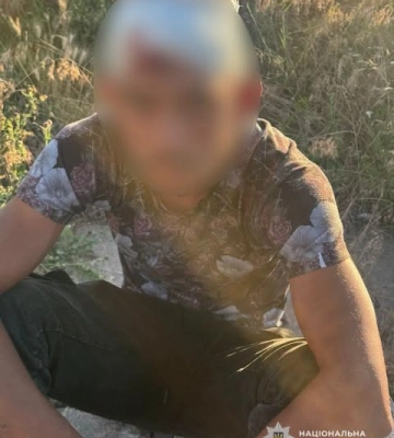 У Кривому Розі повідомлено про підозру молодику, який кинувся з ножем на знайомого