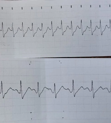 У Луцьку медики швидкої врятували жінку із кардіогенним шоком