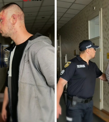 СМИ узнали имя задержанного в связи с нападением на полицейских во Львове, он находится в СОЧ