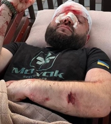 Пробитая голова: в Одесской области мужчина избил военного после замечания по поводу русской музыки