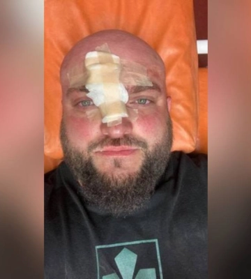 В Затоке жестоко избили ветерана АТО: в полиции уточнили, кем на самом деле является пострадавший