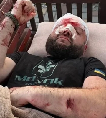 У Затоці чоловік побив ветерана після зауваження про російську музику: поліція відкрила справу