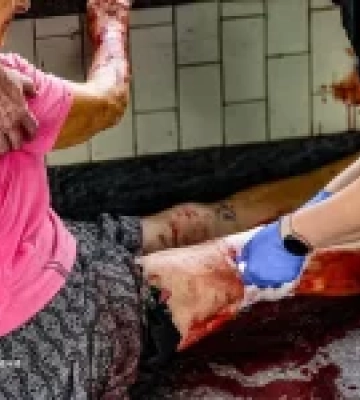 У Київському районі Харкова поранено п’ятьох людей через удар російського дрона