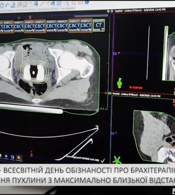 17 липня — Всесвітній день обізнаності про брахітерапію (відео)