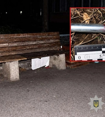 Вдарили металевою палицею по голові: у Дніпрі на Калиновій напали на чоловіка