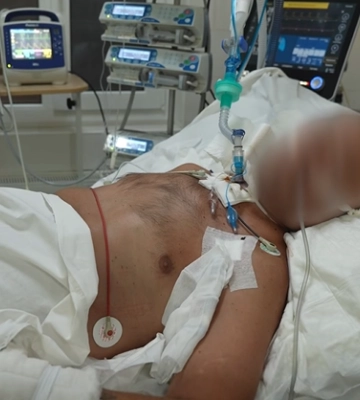 У Харкові врятували військового після клінічної смерті