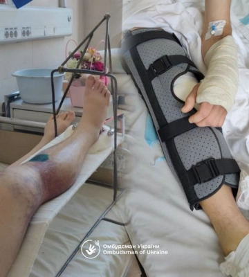 Замість «швидкої» — ТЦК: Офіс Омбудсмана України ініціював розслідування інциденту в Івано-Франківську