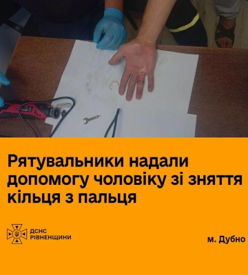 У Дубні чоловік звернувся до рятувальників через кільце, яке не міг зняти