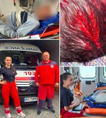 На Закарпатті кінь ледь не покалічив чоловіка: після сильного удару по голові потерпілого терміново госпіталізували