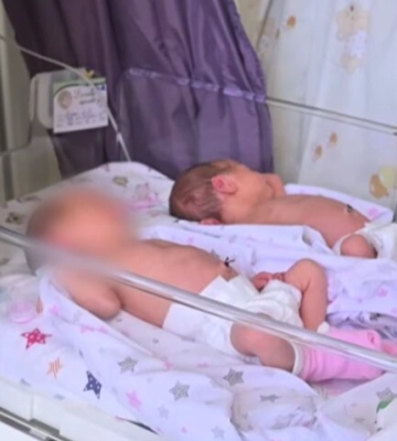 Вперше за п’ять років: у пологовому Рівного народилася трійня