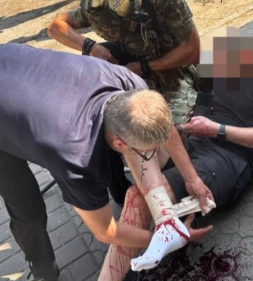 Через російський обстріл Запоріжжя постраждали двоє цивільних