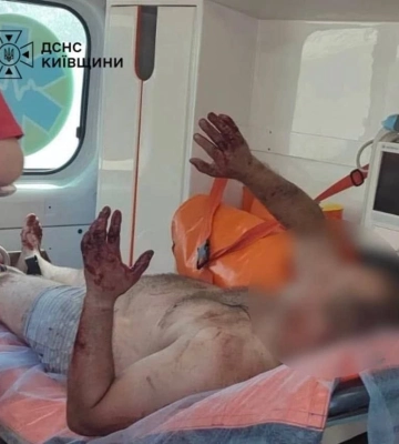На Київщині під час пожежі в приватному будинку загинула людина (ФОТО)