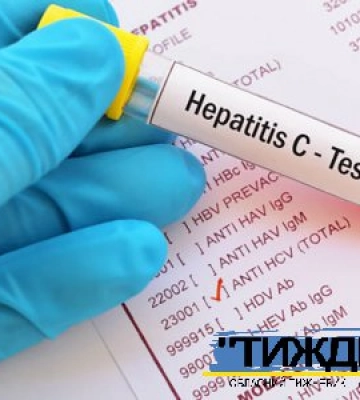 У Тростянці протягом тижня мешканців громади тестуватимуть на вірусні гепатити