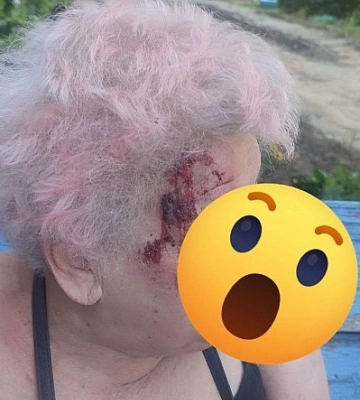 В Корабельному районі на перекопаній дорозі пенсіонерка впала та зламала руку