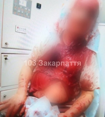 Кривавий інцидент в Ужгороді: домашній улюбленець раптово вчепився господарю в голову