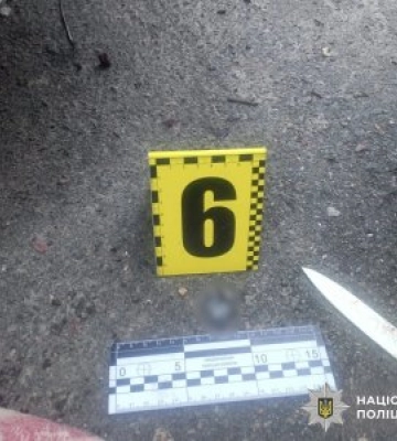 У Миколаєві за доказами слідчих поліції судитимуть чоловіка за спричинення тяжких тілесних ушкоджень знайомому, через відмову дати в борг