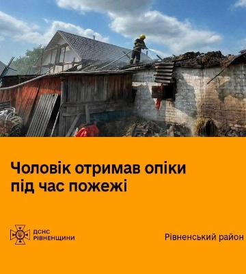 На Рівненщині під час пожежі господарської будівлі постраждав чоловік