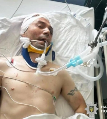 У Костополі поліцейські встановлюють особу постраждалого у ДТП чоловіка