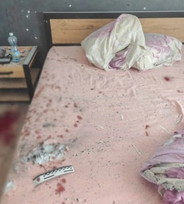 На Рівненщині в руках хлопця вибухнула граната, яку його батько привіз із зони бойових дій