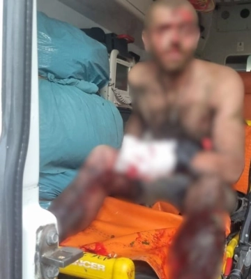 Поблизу Слатиного чоловік підірвався на вибухонебезпечному предметі: постраждалого госпіталізували