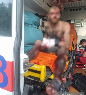 Чоловік підірвався на вибухівці у Харківському районі
