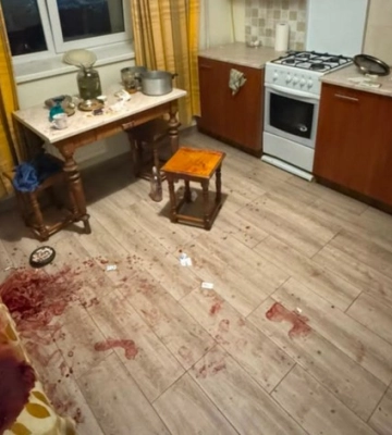 Оглушив табуреткою та вдарив ножем: у Львові сварка чаркувальників закінчилася важкими травмами
