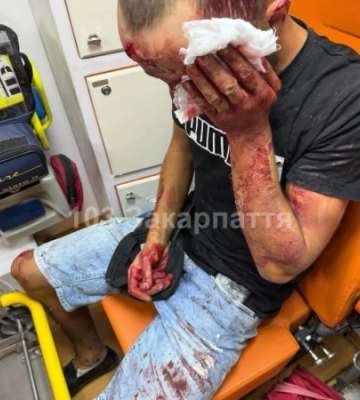 Важка ДТП на Закарпатті: серед чотирьох постраждалих — двоє дітей