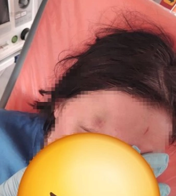 Підвищений тиск виявився жорстоким побиттям: у Мукачеві медики швидкої врятували жертву домашнього насильства