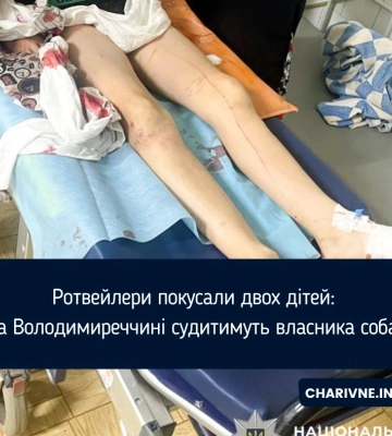 Ротвейлери покусали двох дітей: на Володимиреччині судитимуть власника собак