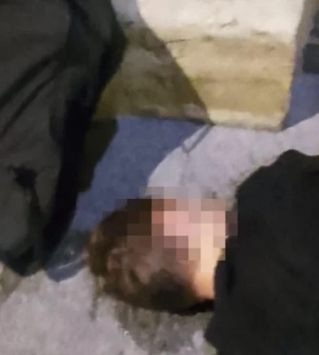 Сломал череп и челюсть: во Львове задержали мужчину, избившего 17-летнего юношу