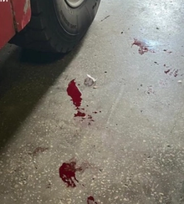 Загарбники атакували пожежну частину на Донеччині, поранені четверо рятувальників