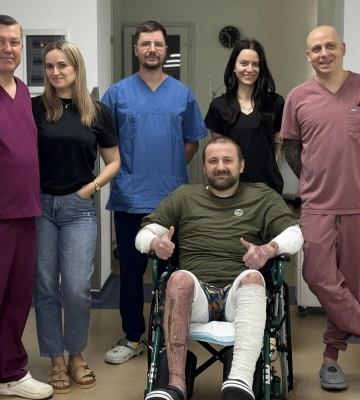 У Львові шкіра тріски й свині допомогла лікарям врятувати двох чоловіків, які отримали 80% опіків тіла