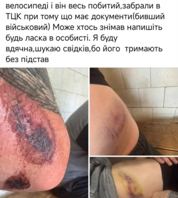 У Чернівцях бус ТЦК збив колишнього військового на велосипеді, – нардеп