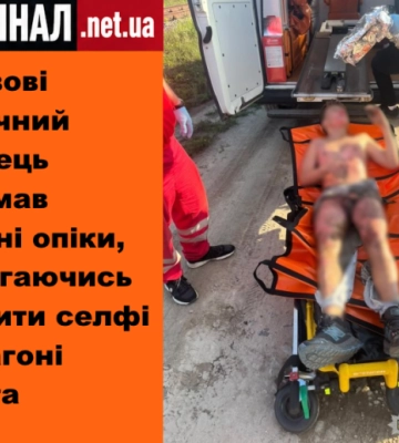 У Львові 13-річний хлопець отримав сильні опіки, намагаючись зробити селфі на вагоні потяга