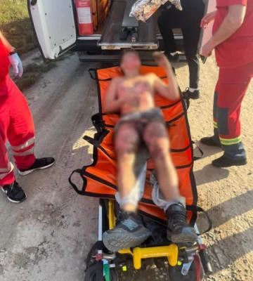 Хотів зробити селфі на вагоні: у Львові 13-річного хлопця уразило струмом